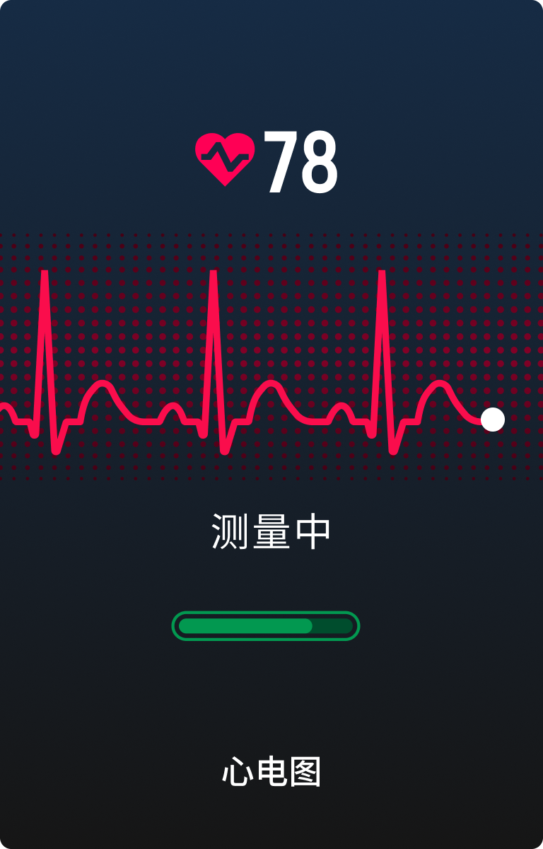 心电图