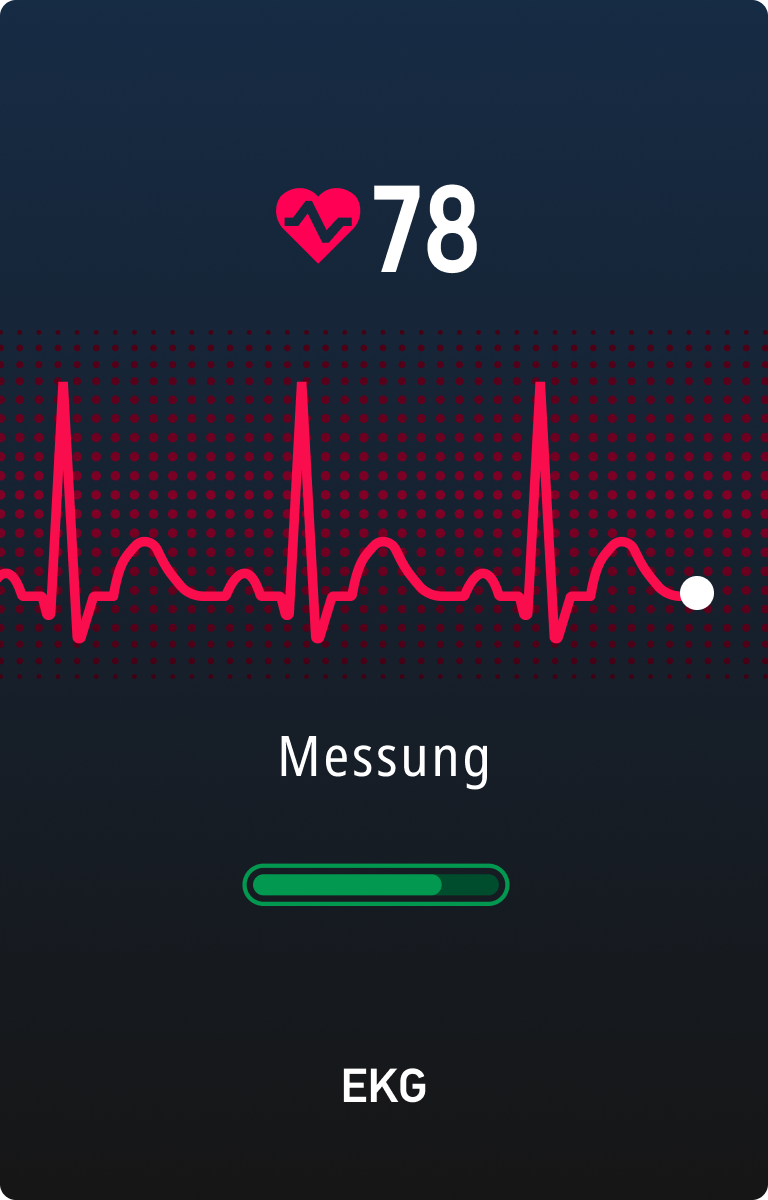 EKG