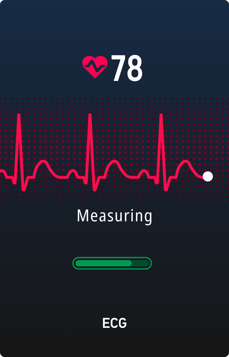 ECG