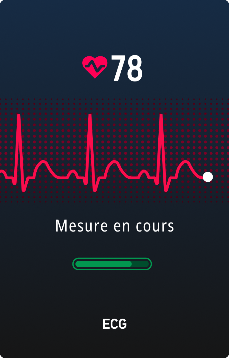 ECG