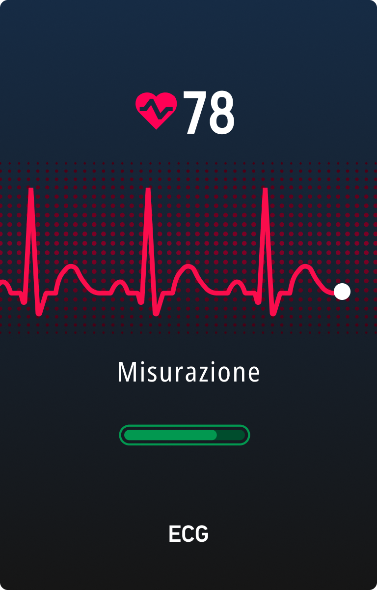 ECG